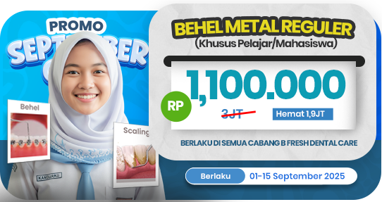 Behel Metal Reguler 1 rahang (Khusus Pelajar/Mahasiswa)